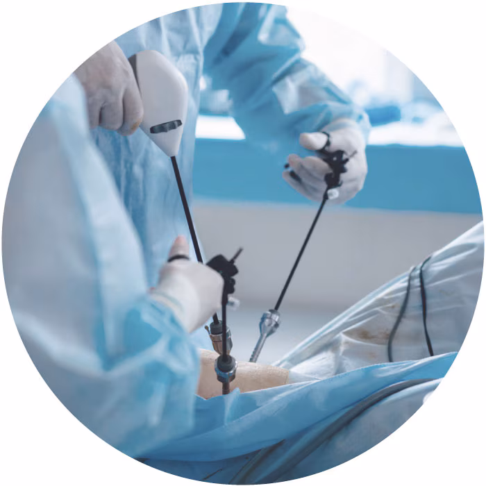 Laparoscopy