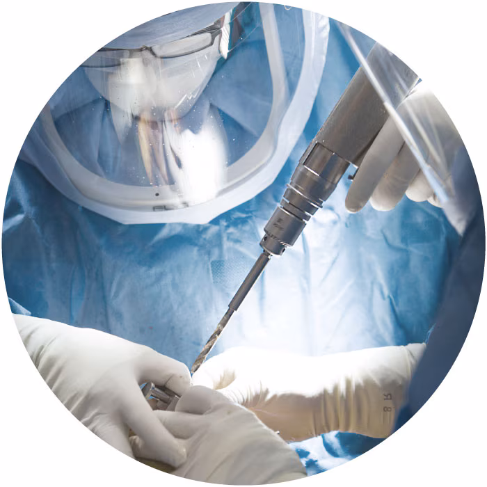 Surgical Power